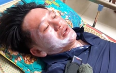 Ba người sống sót thần kỳ trên biển: Bắt cua, cá ăn sống, uống nước mưa cầm hơi