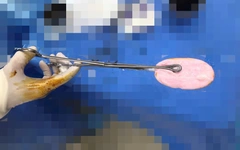 Bác sĩ cảnh báo xu hướng đáng lo gia tăng ở nhóm trẻ gái 10-16 tuổi