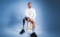 Ngỡ chỉ cảm cúm, cầu thủ Pháp phải cắt một chân do não mô cầu