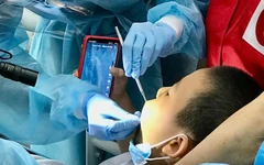 Bác sĩ cảnh báo những đồ ăn dễ gây mòn răng