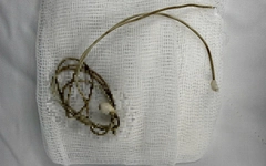 Nam sinh phải mổ khẩn vì dây sạc điện thoại trong bàng quang sau khi bắt chước clip trên mạng