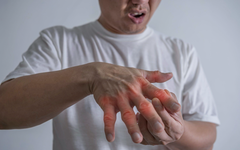 Bệnh gout dễ tái phát, lưu ý những dấu hiệu phải khám sớm