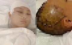 Nữ diễn viên đóng thế bị chấn thương sọ não, dư luận dậy sóng vì sự bất cẩn của đoàn phim