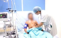 Bị ong vò vẽ đốt hơn 30 vết, người đàn ông 68 tuổi suýt mất mạng