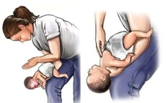 Bé 2 tuổi qua đời do hóc hạt nhãn