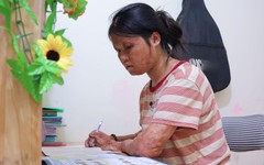 Gương mặt Học bổng Vì tương lai Việt Nam: Ước mơ 'tái sinh' từ ngọn lửa