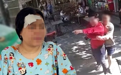 Trích xuất camera, điều tra vụ cô gái bị người đàn ông đánh tét đầu trong quán cà phê