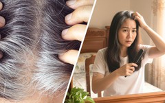 Vì sao tóc bạc sớm có thể là dấu hiệu cơ thể đang tự bảo vệ khỏi ung thư?