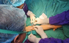 Không gãy xương cổ tay mà vẫn không cầm nắm được, coi chừng trật khớp nguy hiểm