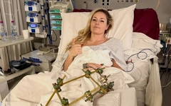 'Nữ hoàng tốc độ' có nguy cơ phải cắt cụt chân sau tai nạn tại Olympic