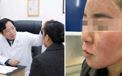 Đang gội đầu được mời ‘làm đẹp cấp tốc’ đón Tết, cô gái hỏng cả khuôn mặt