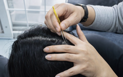 Nhổ tóc bạc cho 'đỡ ngứa mắt', coi chừng tóc không mọc lại