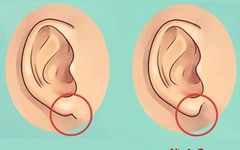 Quiz: Hình dạng dái tai tiết lộ gì về tính cách của bạn?