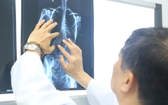 Nhiều trẻ vẹo cột sống nặng mới đi khám, chuyên gia cảnh báo nguy cơ biến chứng nặng