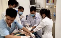 Tại sao người trẻ tuổi vẫn có thể bị đột quỵ?