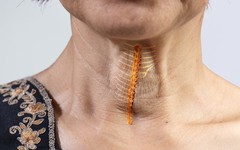 Vì sao mắc xương cá có thể đe dọa đến tính mạng?