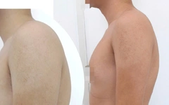 Cổ rụt, lưng gù vì ngồi vẹo vọ, bò dài trên bàn: Chữa thế nào?