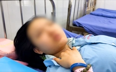Video lời kể của nạn nhân về giây phút sinh tử trong vụ cháy xe khách, 7 người chết ở Đồng Nai