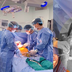 Lần đầu cấy ghép ‘trái tim cơ học’ phù hợp với lồng ngực người Việt