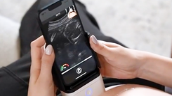 Mỹ phê duyệt thiết bị siêu âm cầm tay của Israel, cho phép thai phụ tự siêu âm tại nhà