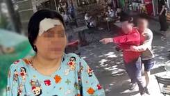 Trích xuất camera, điều tra vụ cô gái bị người đàn ông đánh tét đầu trong quán cà phê