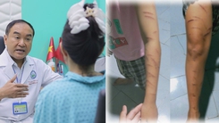 Góc nhìn trưa nay: Ca nâng ngực đặc biệt của bệnh nhân vảy nến; Bé gái nghi bị chị họ dùng dao rạch nhiều nhát