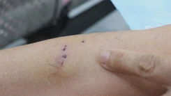 Góc nhìn trưa nay: Người bị chó mèo cắn gia tăng đột biến