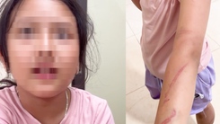 Xác minh vụ cháu bé bị bạo hành với 34 vết thương ở Đắk Lắk
