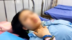 Video lời kể của nạn nhân về giây phút sinh tử trong vụ cháy xe khách, 7 người chết ở Đồng Nai
