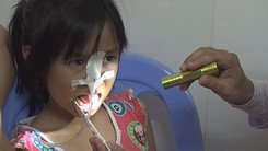 Phẫu thuật thành công cho bé gái bị đũa đâm xuyên lưỡi