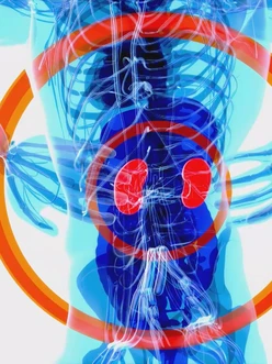 Sống chung với bệnh thận mạn: Điều trị đúng để kéo dài chất lượng sống