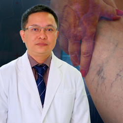 Podcast: Bằng mắt thường, làm sao để nhận biết tình trạng giãn tĩnh mạch ?