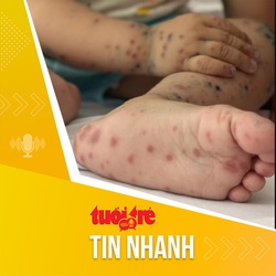 Tin tức sáng 19-6: Ca bệnh tay chân miệng tăng 2,5 lần so với 4 tuần trước