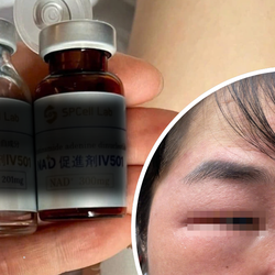 Truyền NAD+ làm đẹp, có tác dụng ‘thần kỳ’ như lời quảng cáo có cánh?