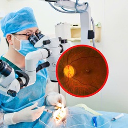 Người trẻ cũng có nguy cơ mất thị lực do bệnh glôcôm