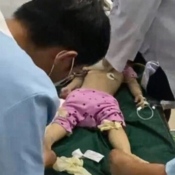 Khuyến cáo của bác sĩ từ vụ bé gái 3 tuổi tử vong do sặc thức ăn