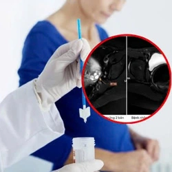 Nữ sinh 17 tuổi được phát hiện là nam sau khi đi khám vì chưa có kinh nguyệt