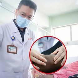 Bác sĩ Bệnh viện Chợ Rẫy nói về tình trạng 9 nạn nhân vụ cháy giàn khoan Sông Đốc