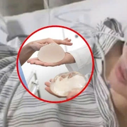 Cô gái Trung Quốc bị đâm hơn 20 nhát, thoát chết nhờ túi nâng ngực