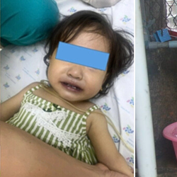 Bé 16 tháng tuổi tím tái sau bữa ăn vì gia đình dùng nước giếng nấu canh