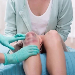 Cẩn trọng với những vết bầm tím bất thường trên cơ thể