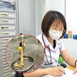 Nhiều người nhiễm sán dây, gặp biến chứng nặng do thói quen ăn đồ sống