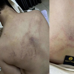 Lời của người cha tố cô giáo mầm non đánh, kéo lê, ném bé gái 4 tuổi vào tường