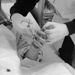 Nhiều ca cấp cứu nặng do pháo nổ, bác sĩ Bệnh viện Hữu nghị Việt Đức khuyến cáo điều gì?