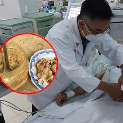 Vụ ngộ độc khi ăn cá ủ chua: Bác sĩ chỉ cách nhận biết thực phẩm chứa độc tố botulinum