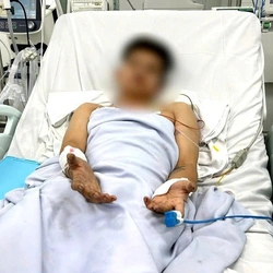 Lời kể của người đàn ông thoát 'lưỡi hái tử thần' trong vụ cháy nhà trọ ở TP.HCM