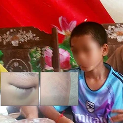 Người cô cầu cứu khi cháu 12 tuổi nghi bị cha và mẹ kế bạo hành