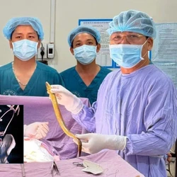 Gắp con lươn dài hơn nửa mét khỏi ổ bụng nam bệnh nhân