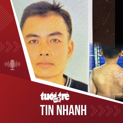 Tin tức tối 8-5: Khởi tố người cha đánh con ruột gây thương tích 36%