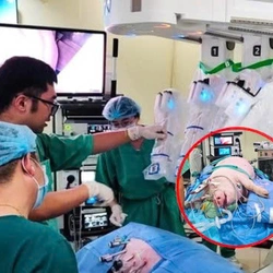 Thử nghiệm cánh tay robot phẫu thuật cắt túi mật, dạ dày cho heo